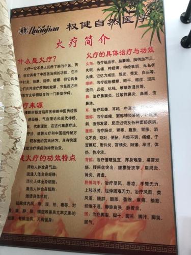 店内火疗简介。 店内火疗简介。